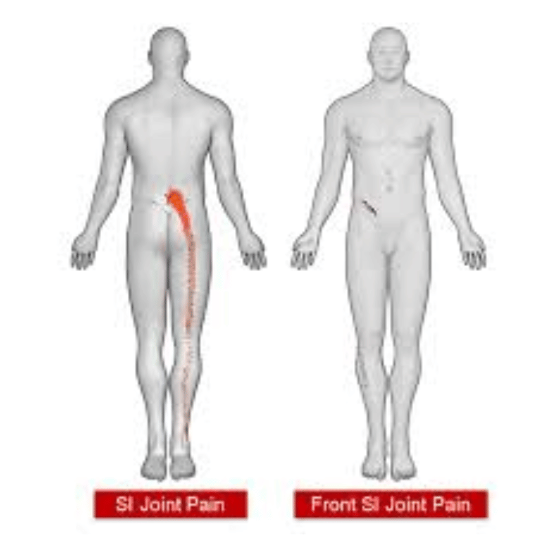 si joint treatment