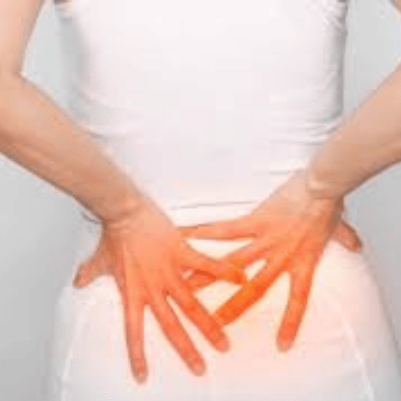 coccygectomy